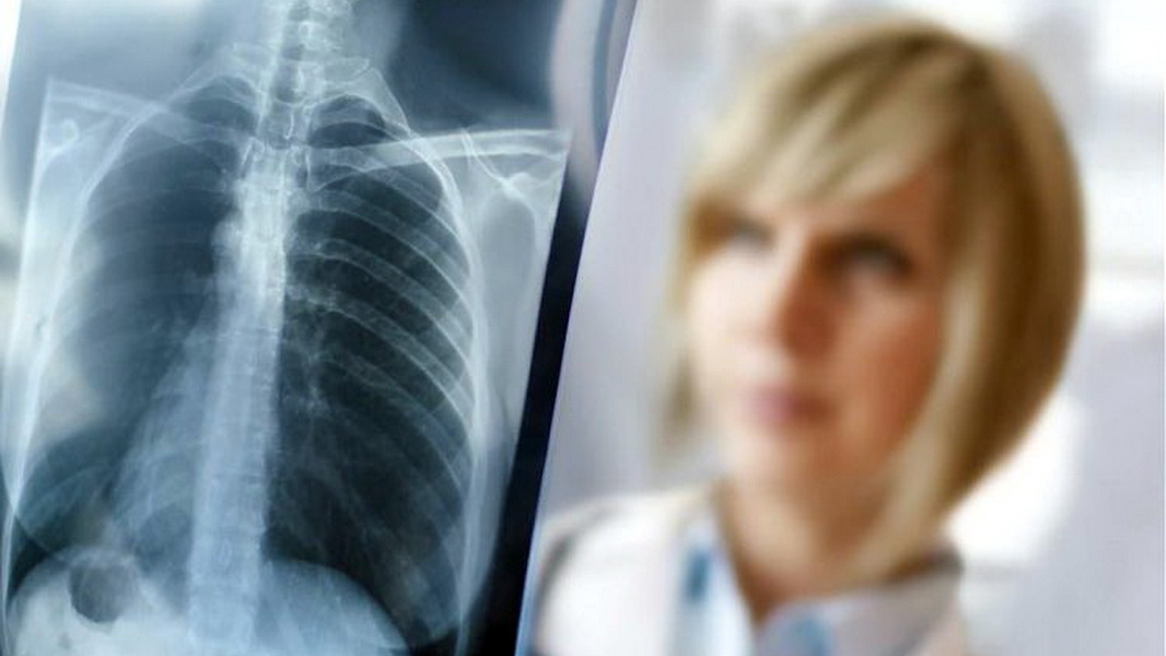 Опровержение информации об очаге туберкулеза в квартале «Дубки» города Ступино